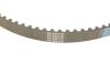 Комплект ГРМ Land Rover Discovery/Range Rover 2.7D 04- (82zx20) HEPU 20-2079 (фото 3)