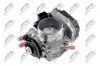 NTY ETB-VW-013 Корпус дросельної заслонки Audi A3, Skoda Octavia, VW Caddy, Golf, Passat ETB-VW-013